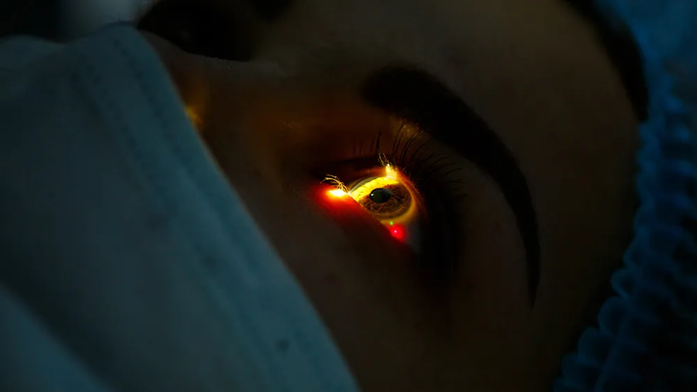 SMILE vs PRK: Which Laser Eye Surgery Is Right for You